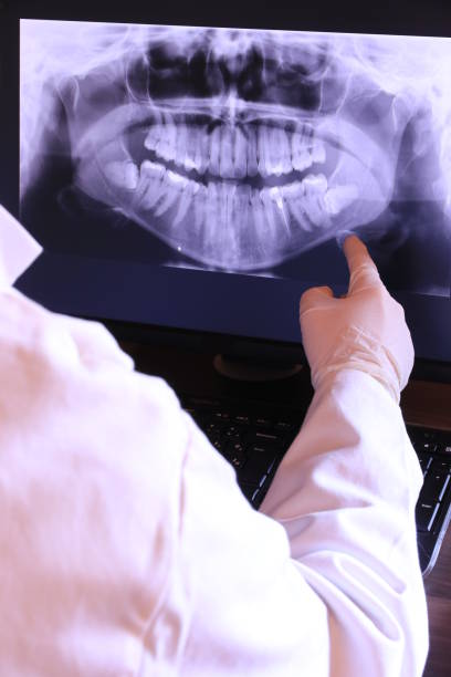 Best Broken Tooth Emergency  in Waymart, PA