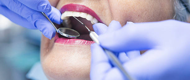Best Chipped Tooth Repair Near Me  in Waymart, PA